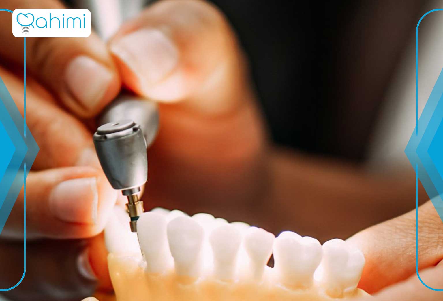 درمان ایمپلنت دندان در قم چقدر طول می کشد؟
