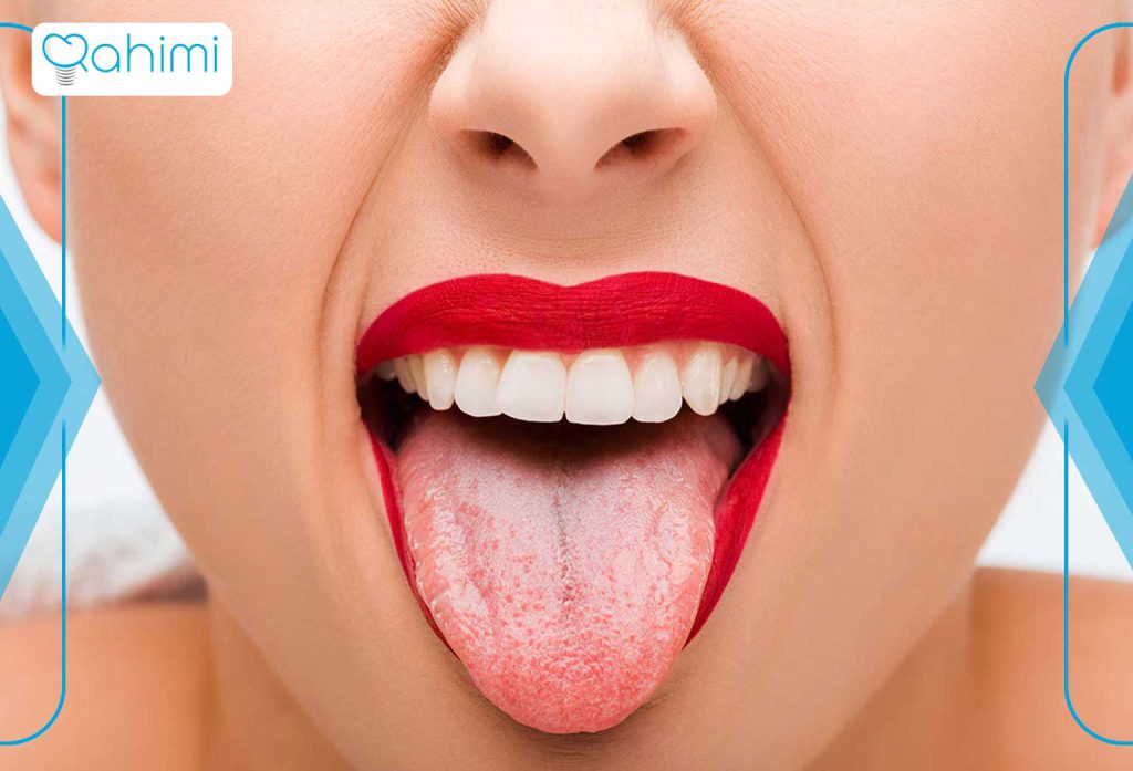 چرا تمیز کردن زبان مهم است؟ 1 عکس زبان سالم