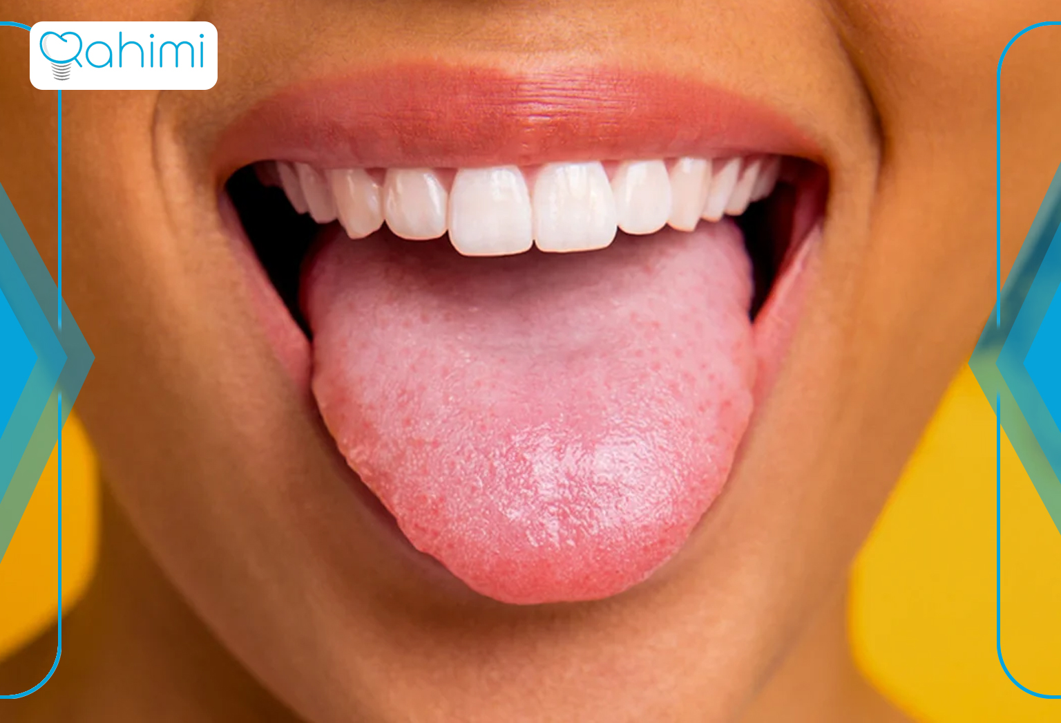 تشخیص زبان سبز و درمان سریع این بیماری 1 Photo of healthy tongue