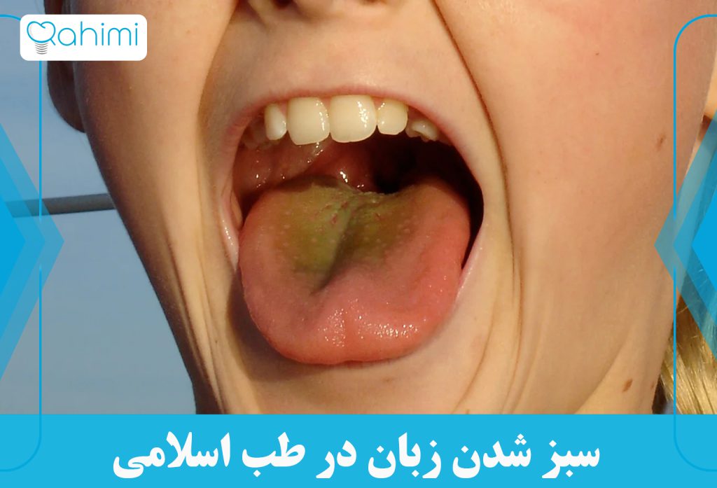 تشخیص زبان سبز و درمان سریع این بیماری 6 سبز شدن زبان در طب اسلامی