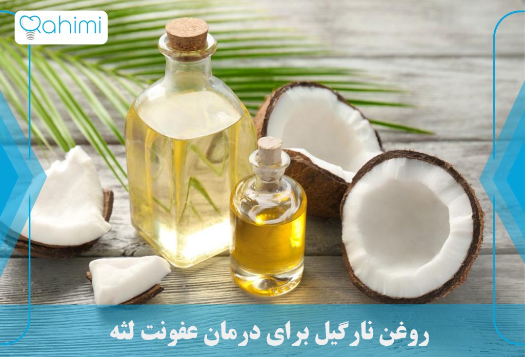 درمان عفونت لثه در خانه 9 روغن نارگیل برای درمان عفونت لثه