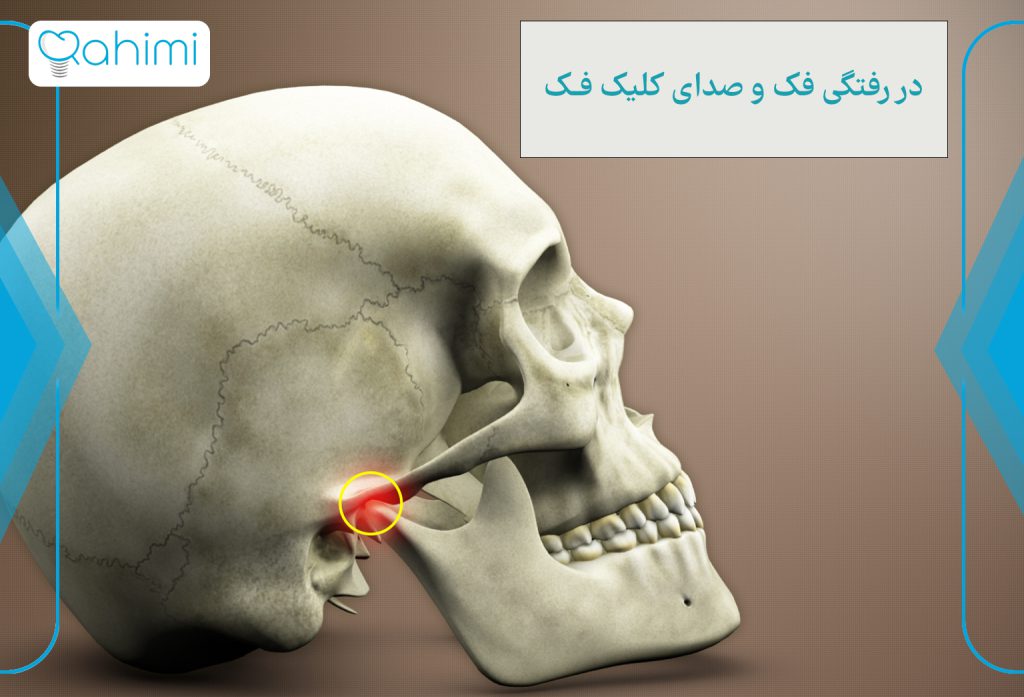 دررفتگی فک