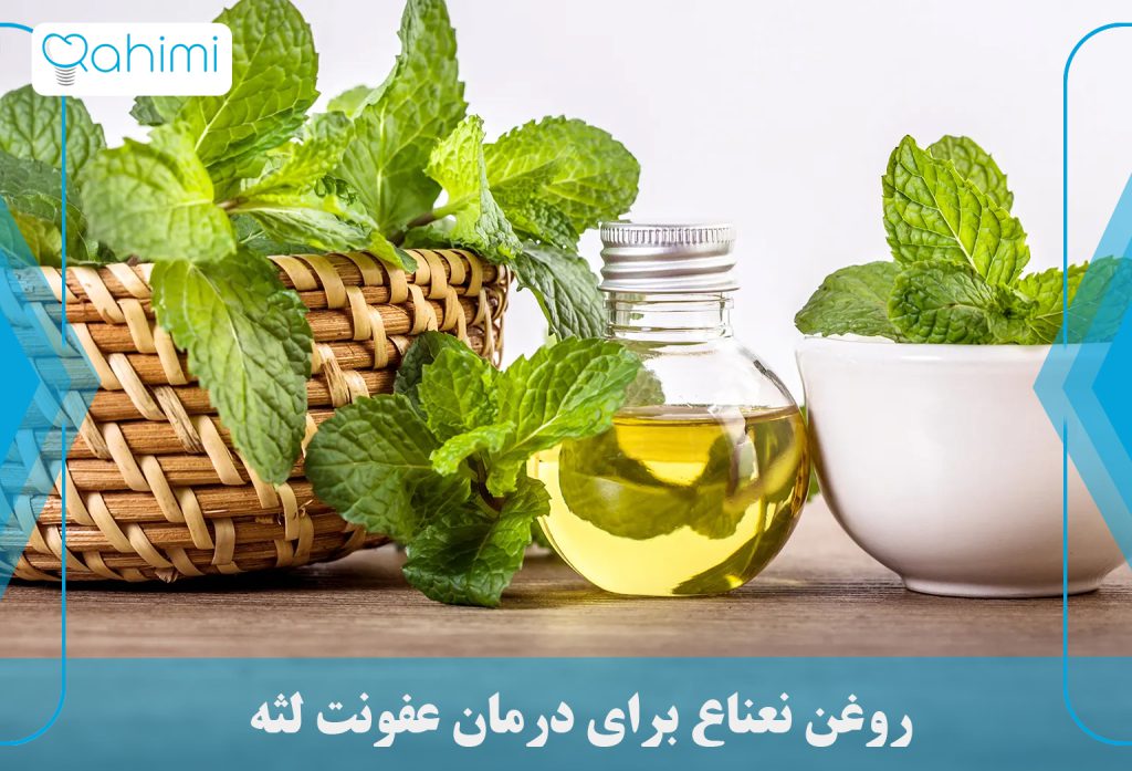 درمان عفونت لثه در خانه 19 روغن نعناع برای درمان عفونت لثه