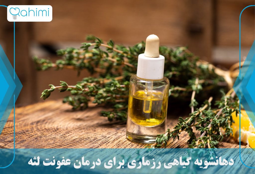 درمان عفونت لثه در خانه 22 Rosemary herbal mouthwash
