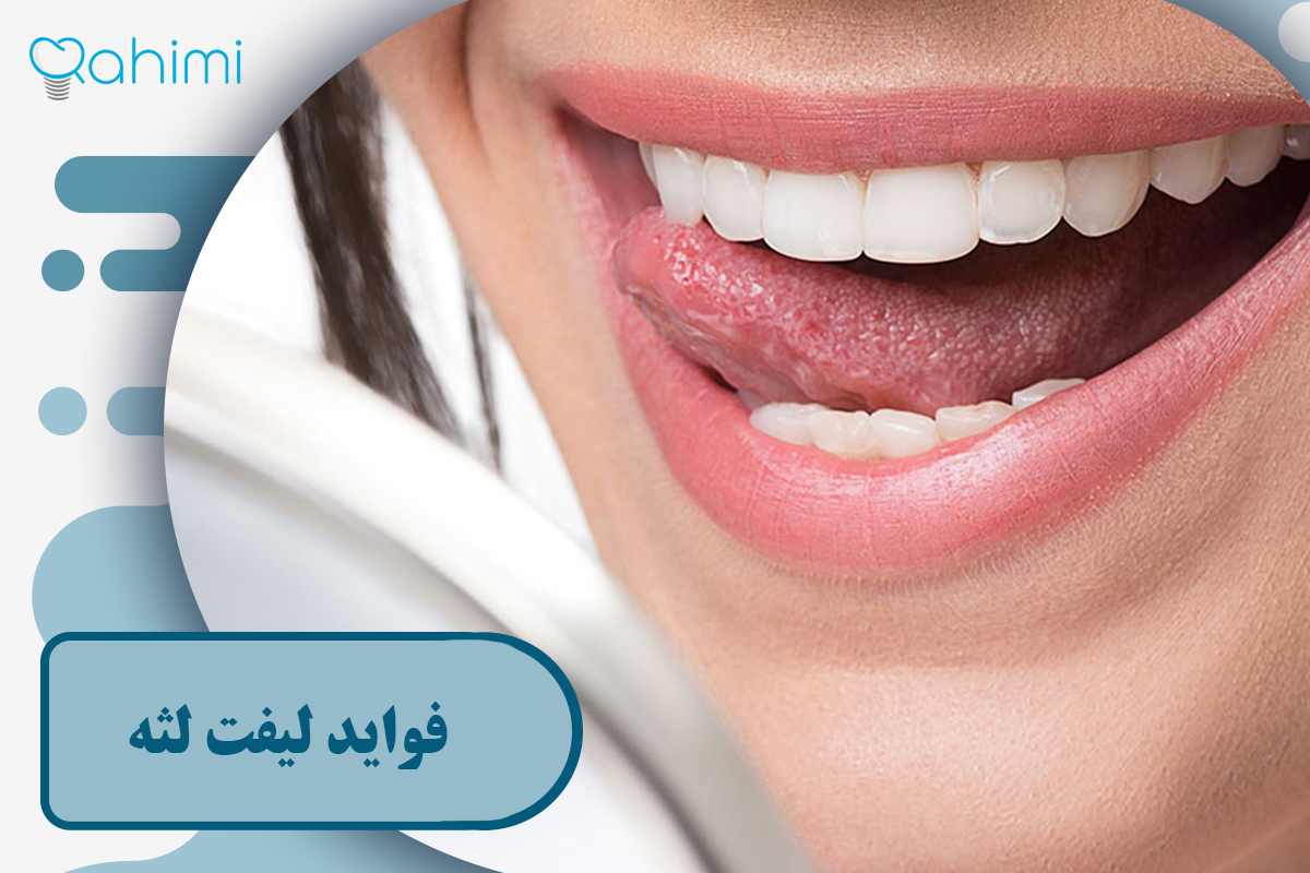 فواید لیفت لثه
