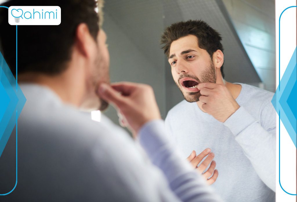 سیاه ‌شدن لثه بعد از ایمپلنت دندان