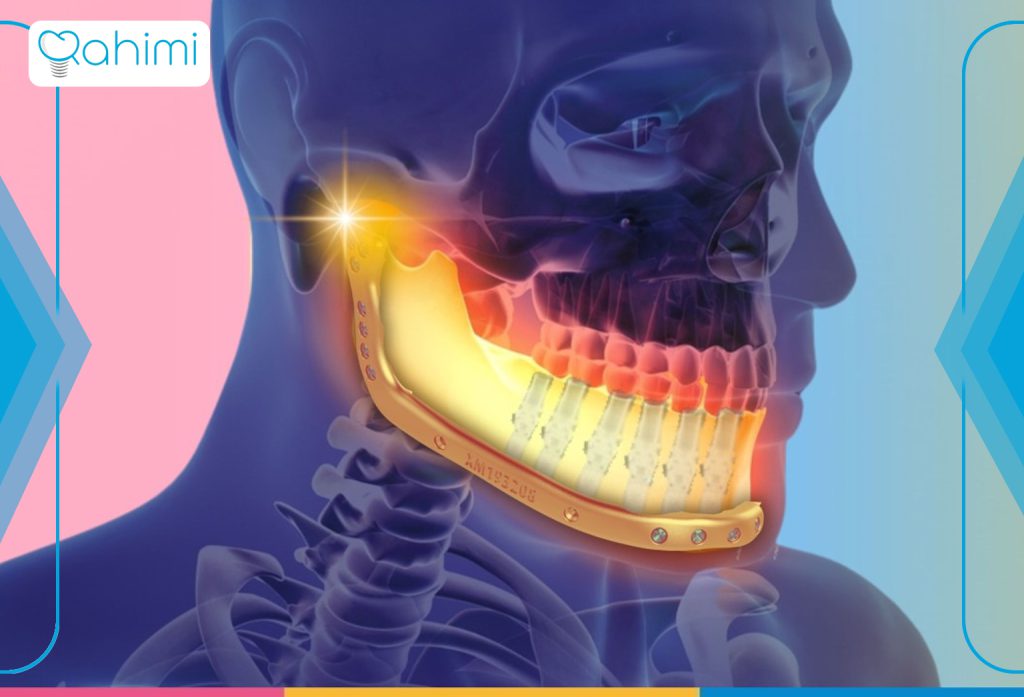 11 نشانه اصلی سرطان فک چیست؟ 4 سرطان فک پایین