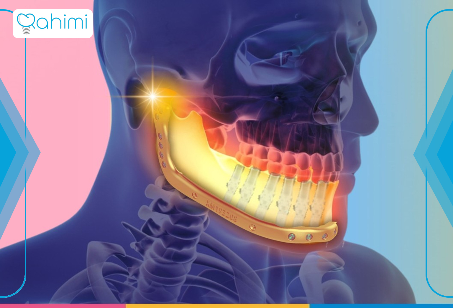 11 نشانه اصلی سرطان فک چیست؟ 4 Lower jaw cancer