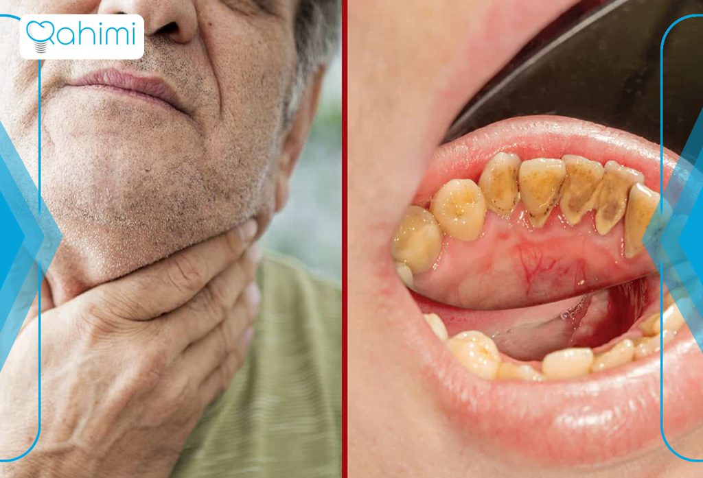 11 نشانه اصلی سرطان فک چیست؟ 1 سرطان فک