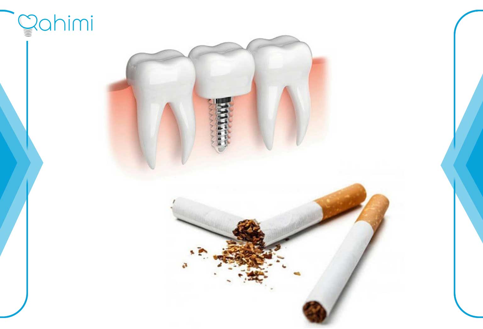 مصرف دخانیات در ایمپلنت دندان