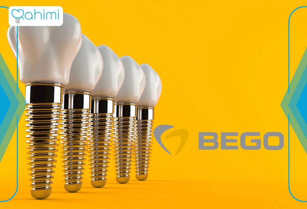 بهترین ایمپلنت دندان چیست؟ بهترین برندهای ایمپلنت دندان در سال 2024 7 ایمپلنت Bego