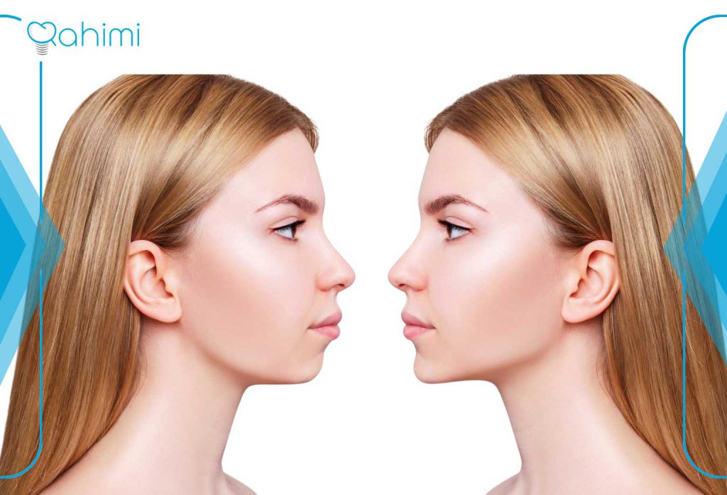همه چیز در مورد ارتوسرجری 1 اصلاح ناهنجاریهای فک