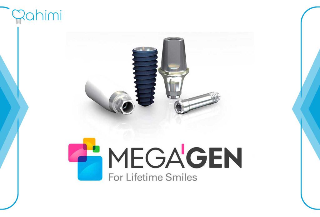 بهترین ایمپلنت دندان چیست؟ بهترین برندهای ایمپلنت دندان در سال 2024 8 ایمپلنت MegaGen