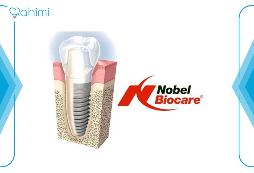 بهترین ایمپلنت دندان چیست؟ بهترین برندهای ایمپلنت دندان در سال 2024 5 نوبل بیوکر (Nobel Biocare)