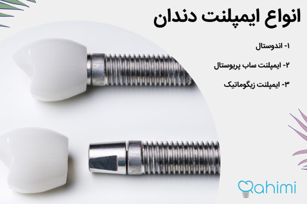 بهترین ایمپلنت دندان چیست؟ بهترین برندهای ایمپلنت دندان در سال 2024 1 انواع ایمپلنت دندان