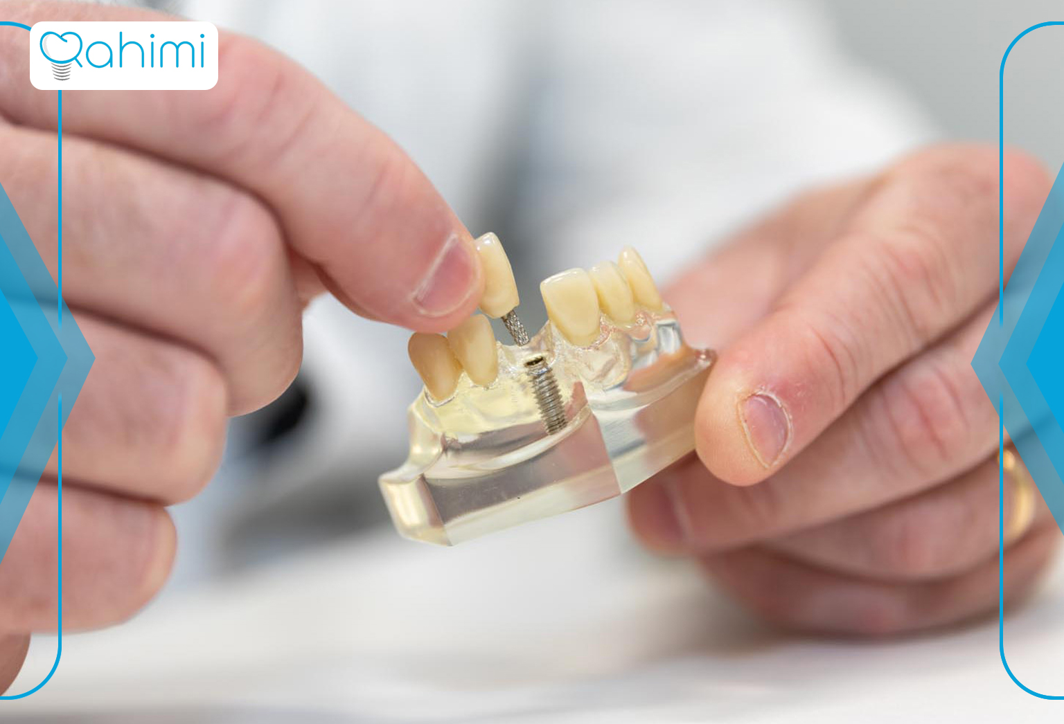 دکتر رحیمی: پیشگام در کاشت دندان در قم 2 Implant treatment steps 1