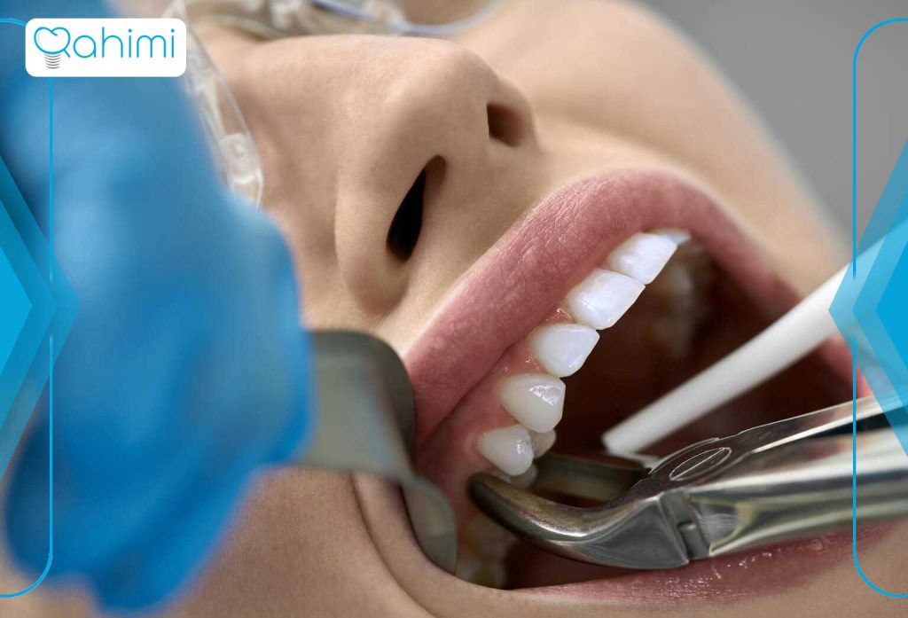 همه چیز در مورد جراحی دندان 5 نکات مهم قبل و بعد از جراحی دندان