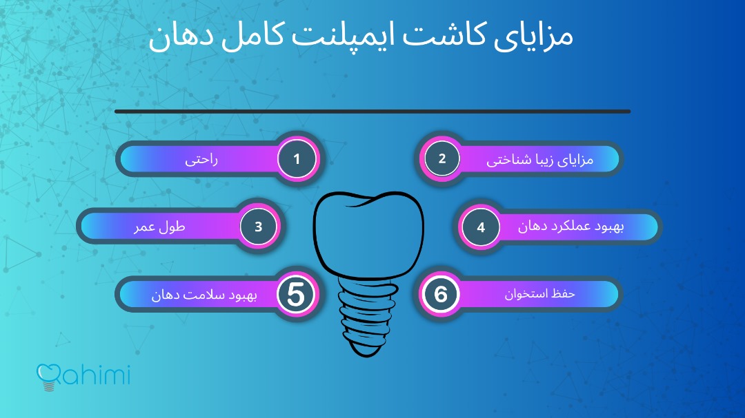 مزایای کاشت دندان کامل دهان