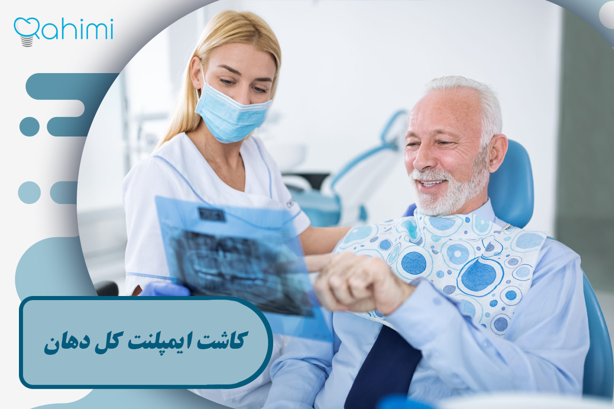 کاشت ایمپلنت کل دهان
