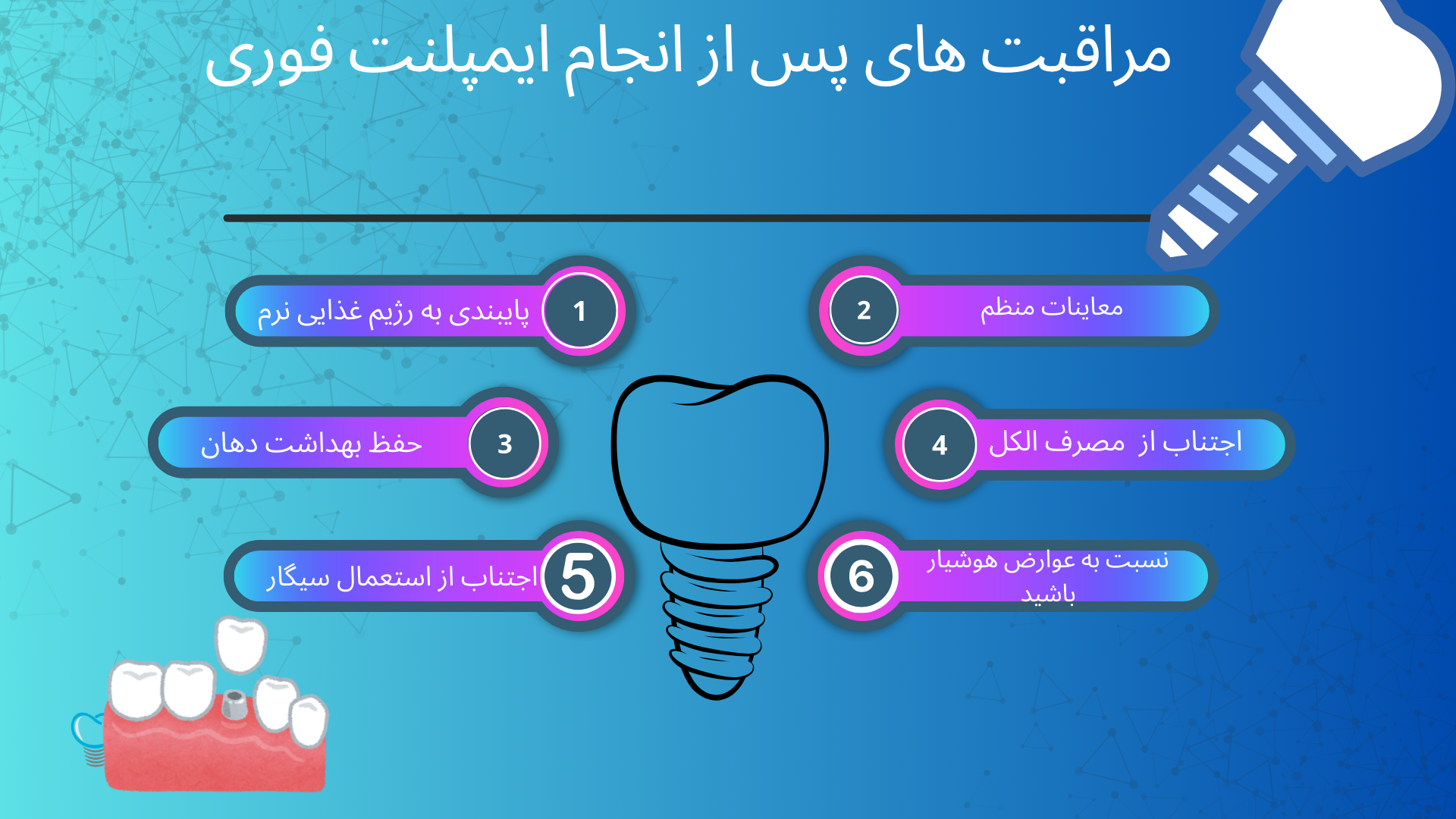 مراقبت های پس از انجام ایمپلنت فوری