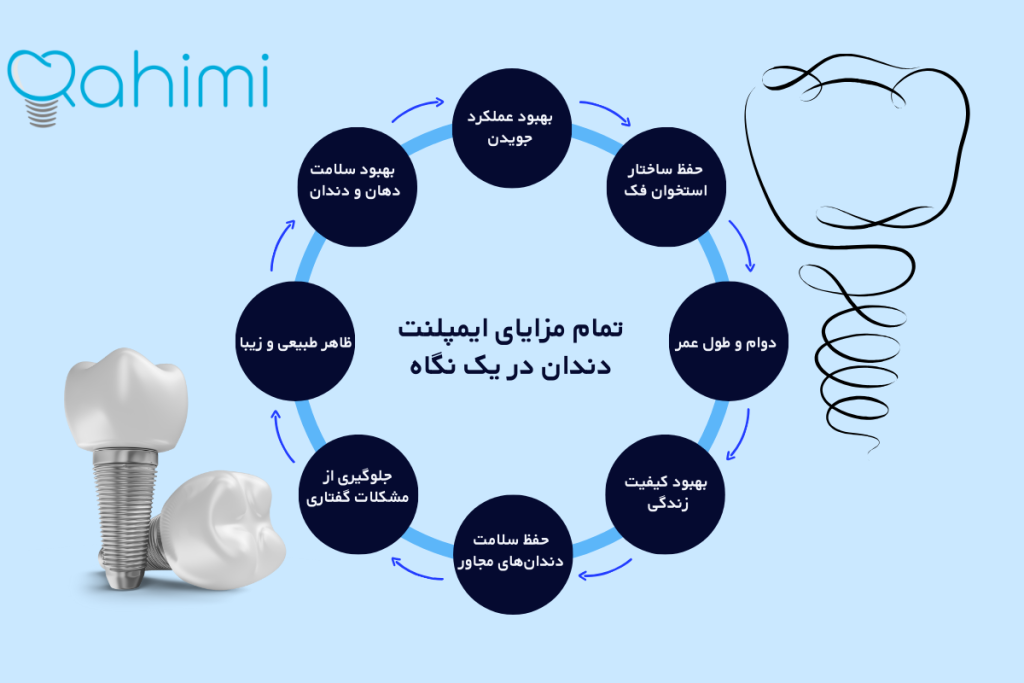 ۲۰ مزایای ایمپلنت دندان: از استحکام تا زیبایی 1 تمام مزایای ایمپلنت دندان در یک نگاه