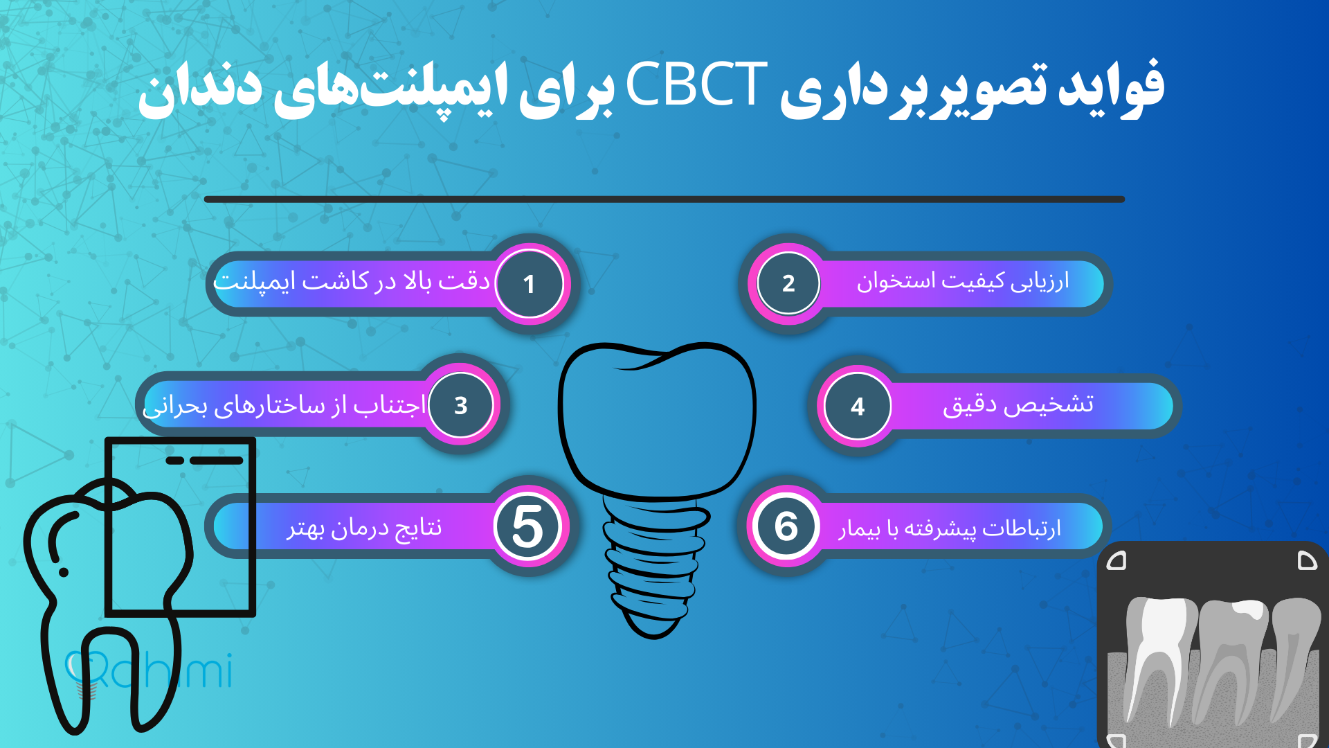 فواید تصویربرداری CBCT برای ایمپلنت‌های دندان 