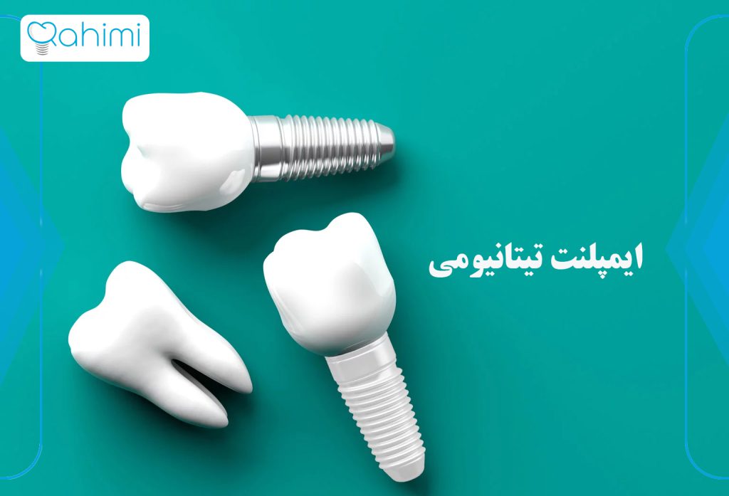 ایمپلنت تیتانیومی یا سرامیکی کدام بهترین انتخاب است؟ 1 ایمپلنت تیتانیومی