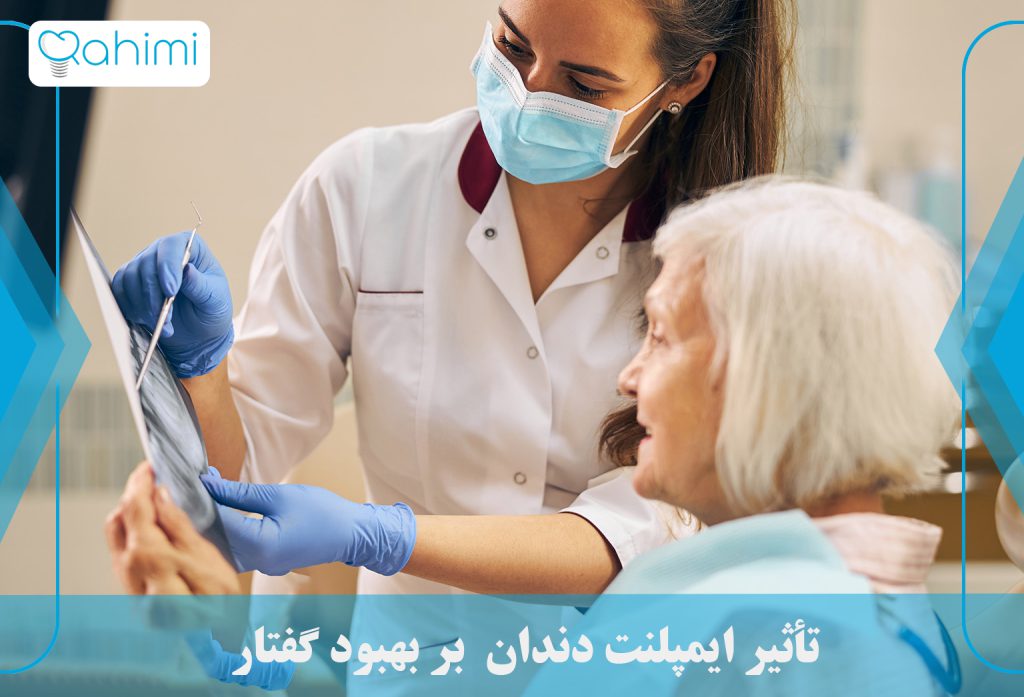 تأثیر ایمپلنت دندان بر بهبود گفتار