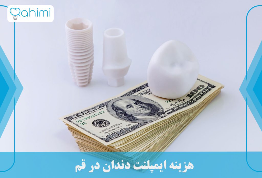هزینه ایمپلنت دندان در قم