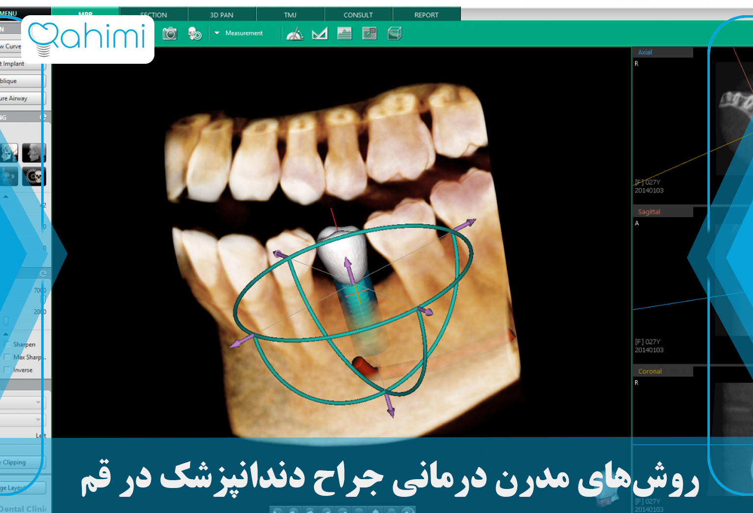 جراح دندانپزشکی قم و روش‌های مدرن درمانی