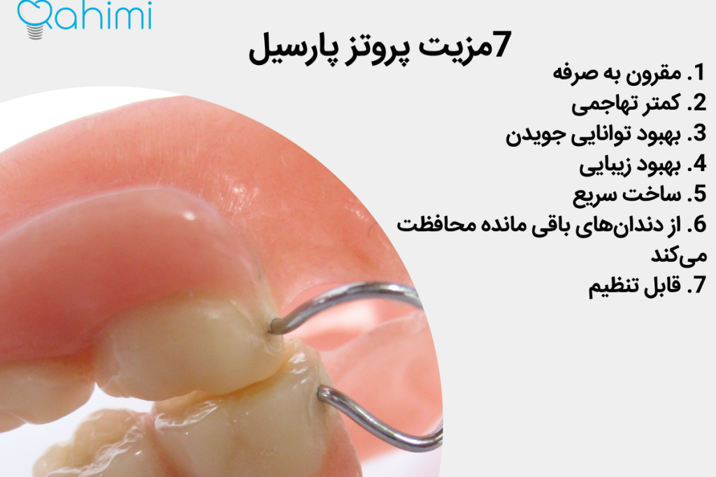 7مزایای پروتز پارسیل
