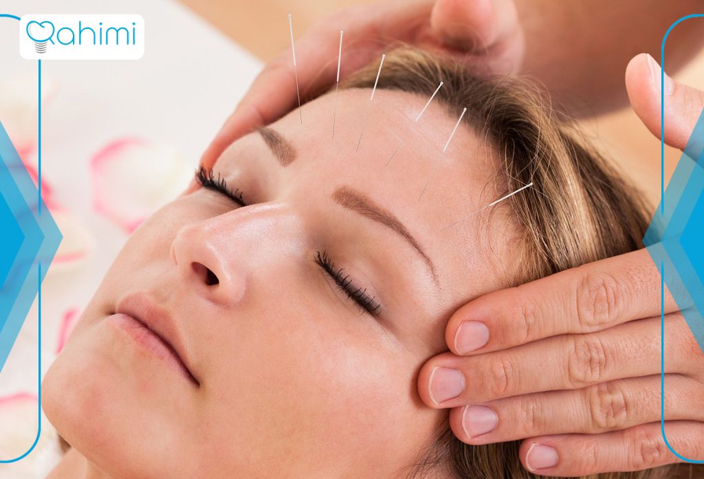 آیا بی حسی صورت یک موقعیت نگران کننده است؟ 5 طب سوزنی برای درمان بی حس شدن صورت