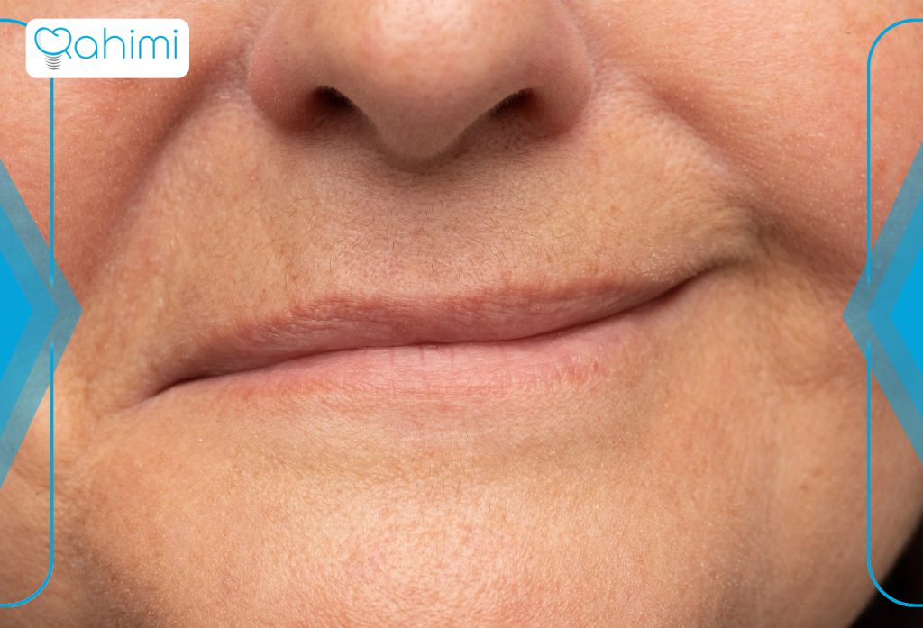 آیا بی حسی صورت یک موقعیت نگران کننده است؟ 2 بیماریهای خودایمنی بر بیحسی صورت
