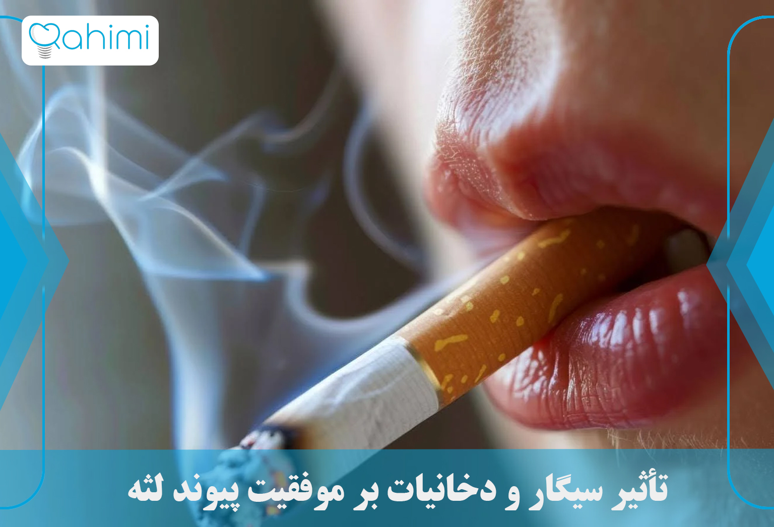 تأثیر سیگار و دخانیات بر موفقیت پیوند لثه