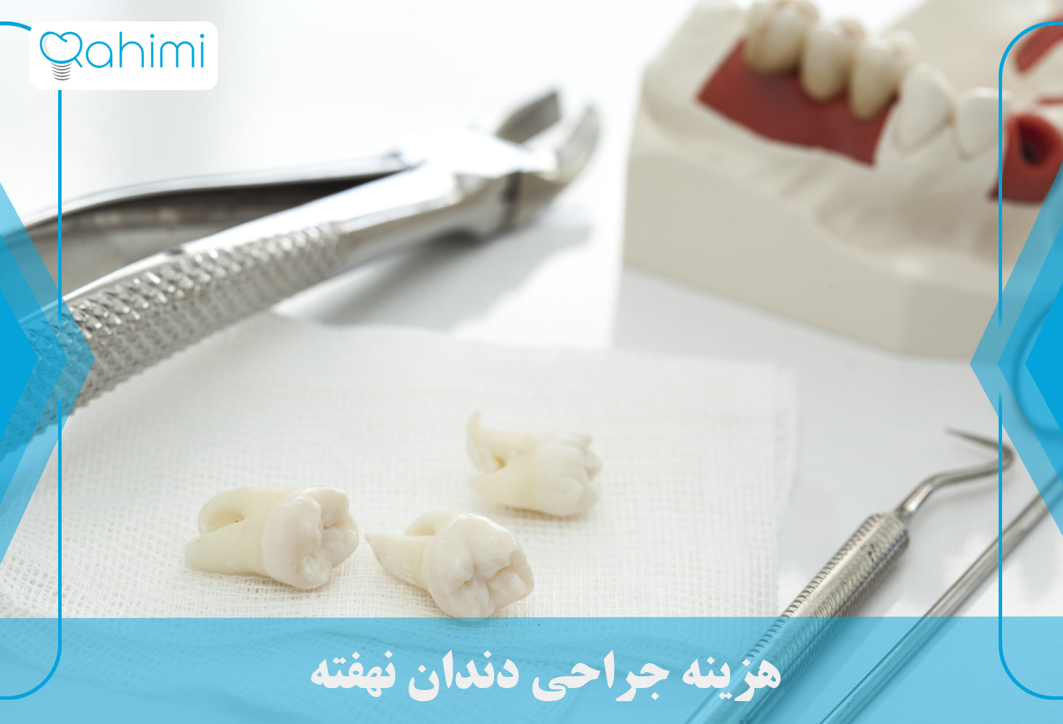 هزینه جراحی دندان نهفته