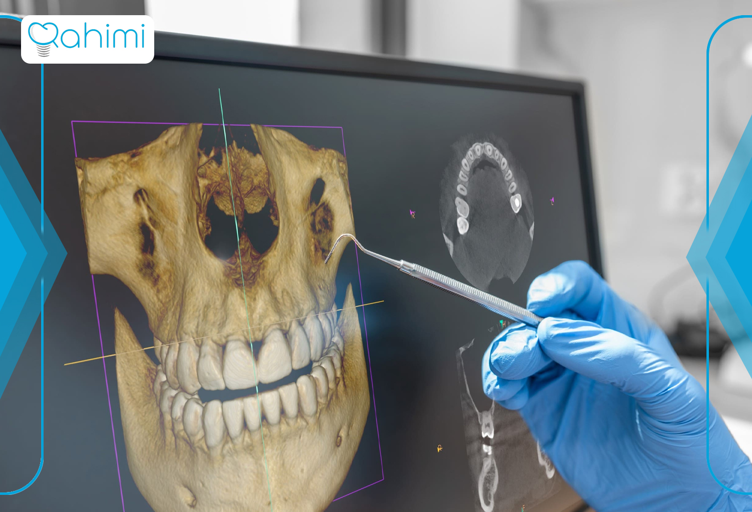 خطرات و معایب CBCT در رادیولوژی دندانپزشکی