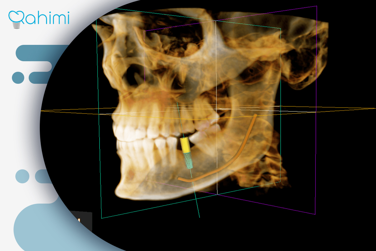تصویربرداری دیجیتال CBCT 
