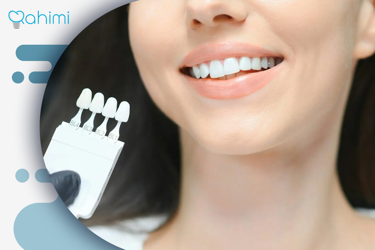تاثیر دندانپزشکی زیبایی بر بهبود کیفیت زندگی