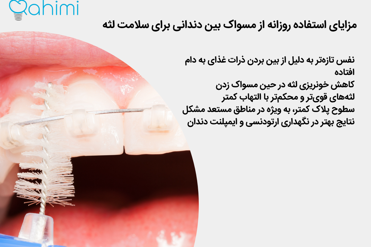 مزایای استفاده روزانه از مسواک بین دندانی برای سلامت لثه