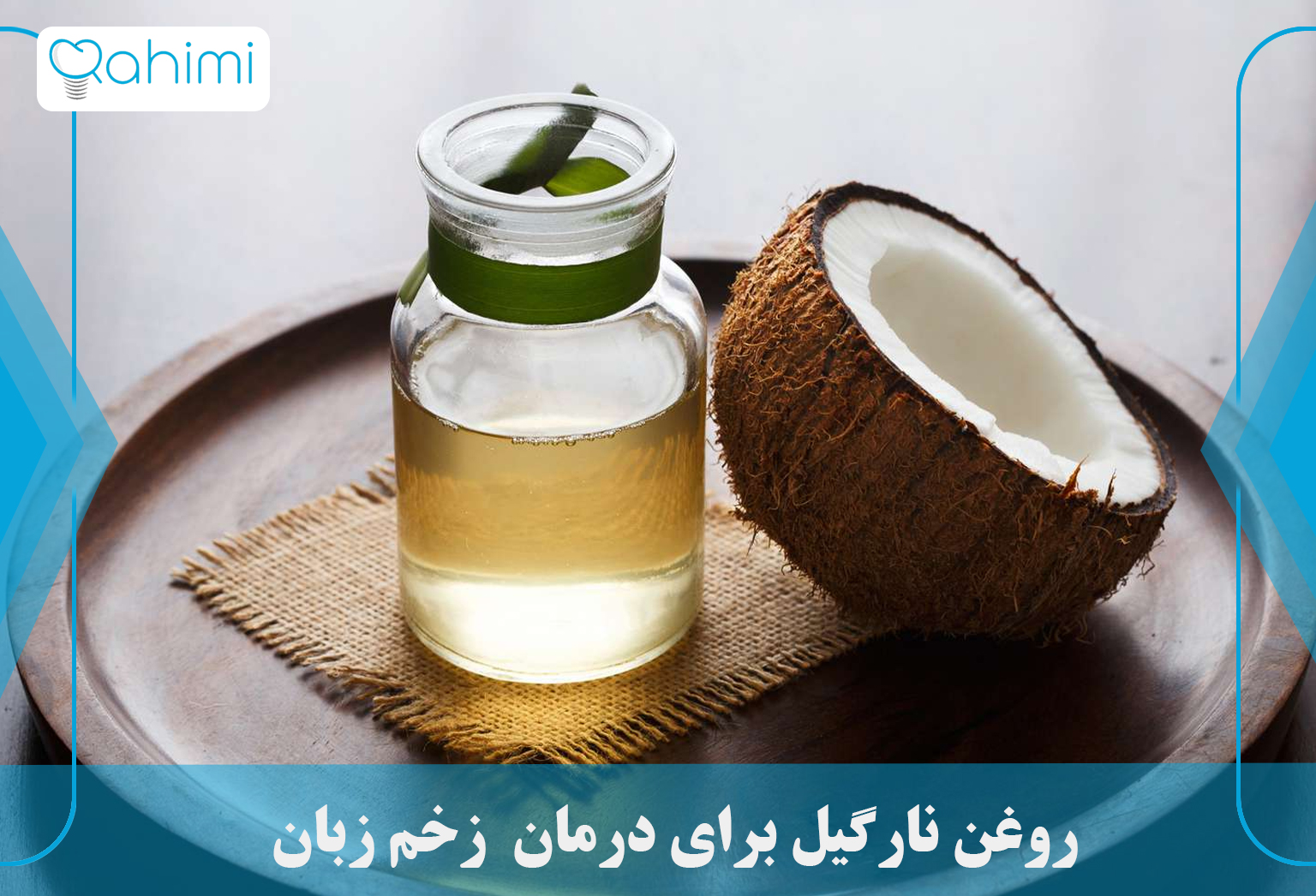 درمان آفت دهان و زخم زبان و لب 7 Coconut oil to treat tongue ulcers