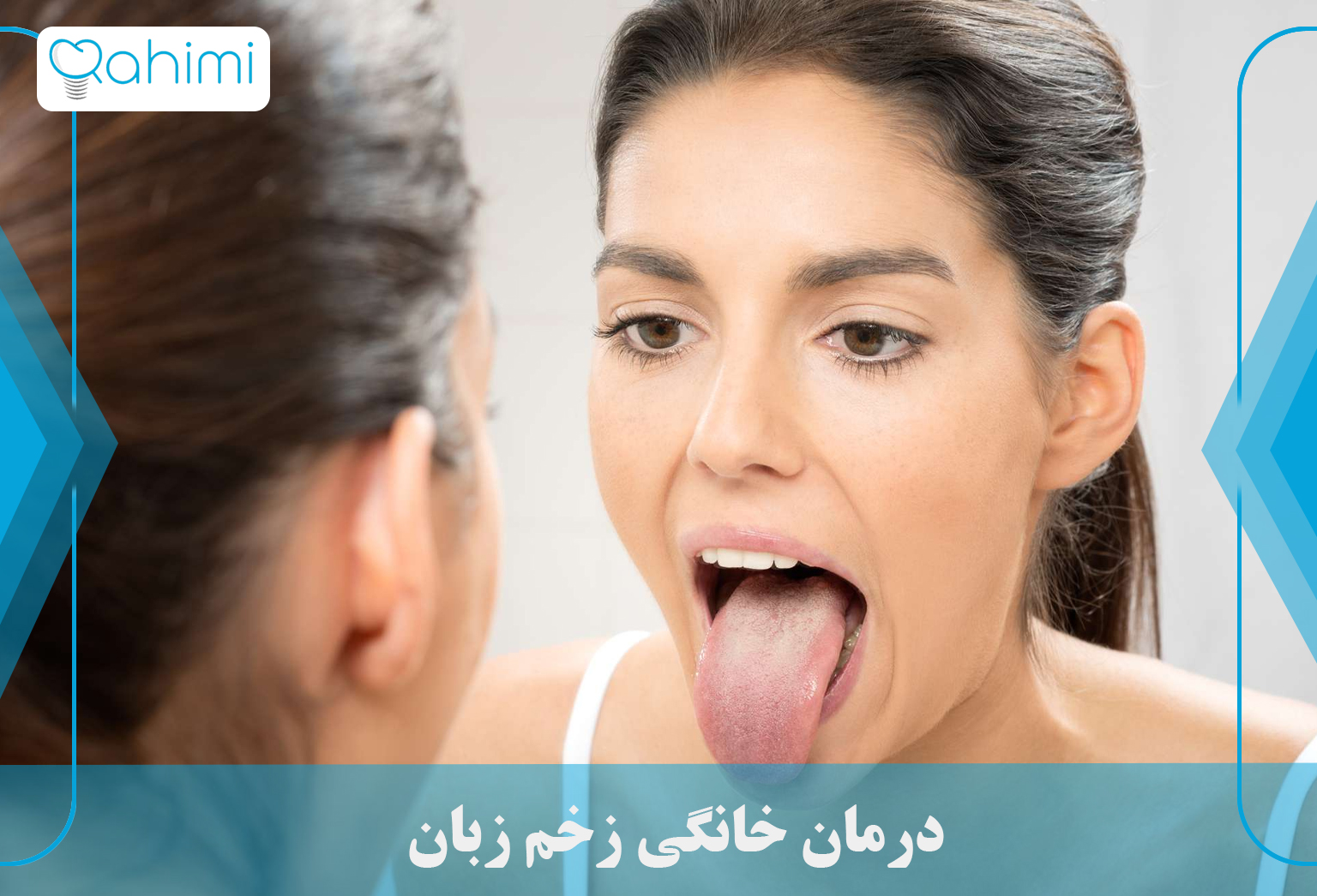 درمان آفت دهان و زخم زبان و لب 6 Home treatment of tongue ulcer
