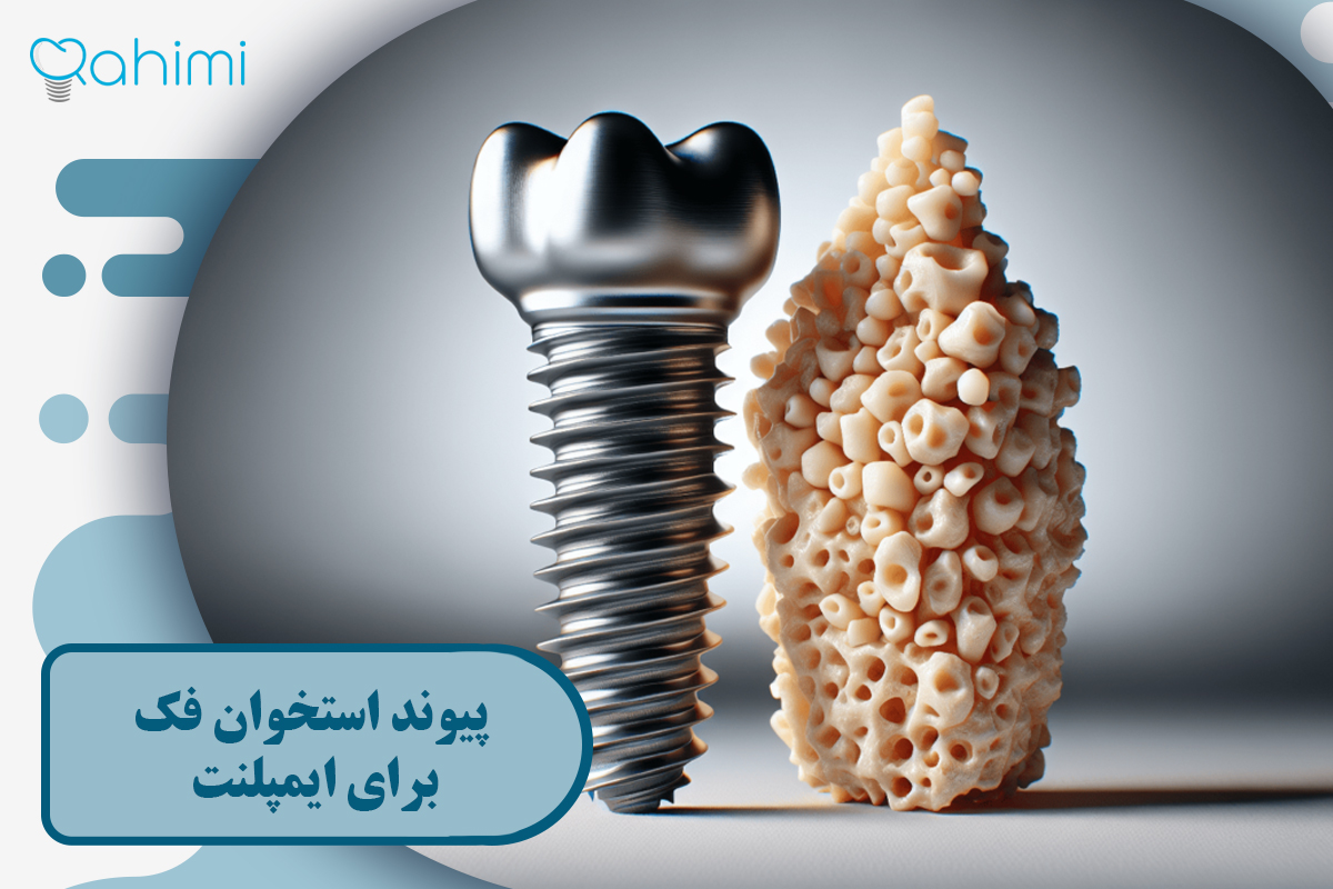 پیوند استخوان فک برای ایمپلنت