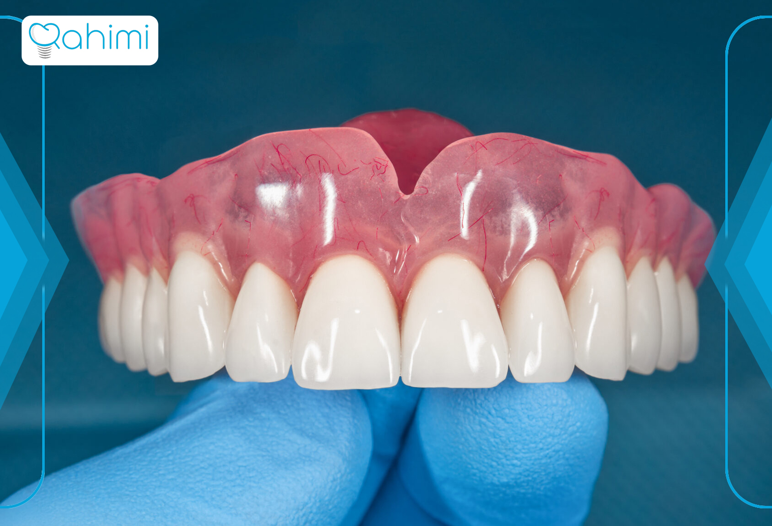 دندان مصنوعی موقت: نگهداری زیبایی دندان ها تا آماده شدن دندانهای دائمی 8 Temporary artificial teeth in Qom
