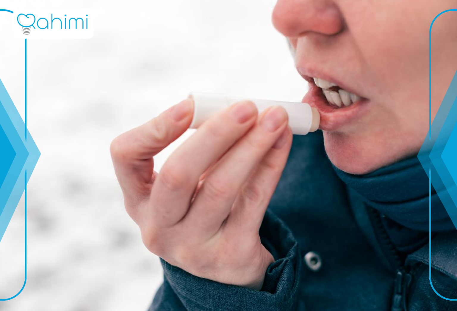 درمان آفت دهان و زخم زبان و لب 13 Treatment of lip ulcer