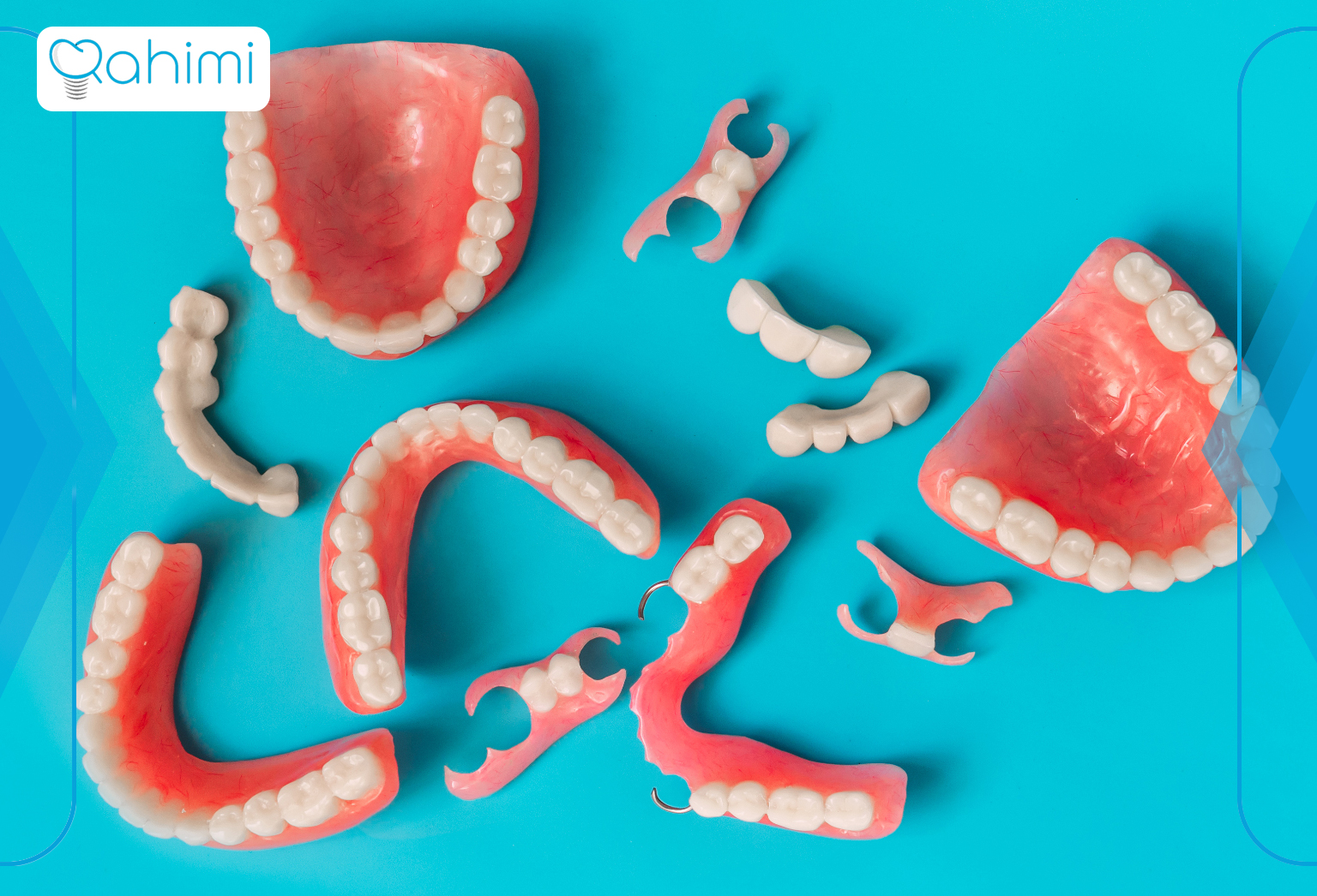 دندان مصنوعی موقت: نگهداری زیبایی دندان ها تا آماده شدن دندانهای دائمی 1 Types of artificial teeth
