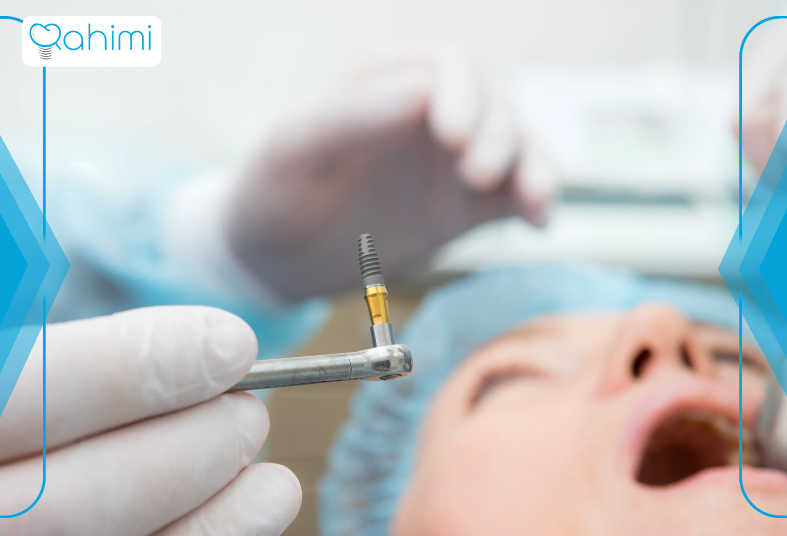 Implant placement under anesthesia