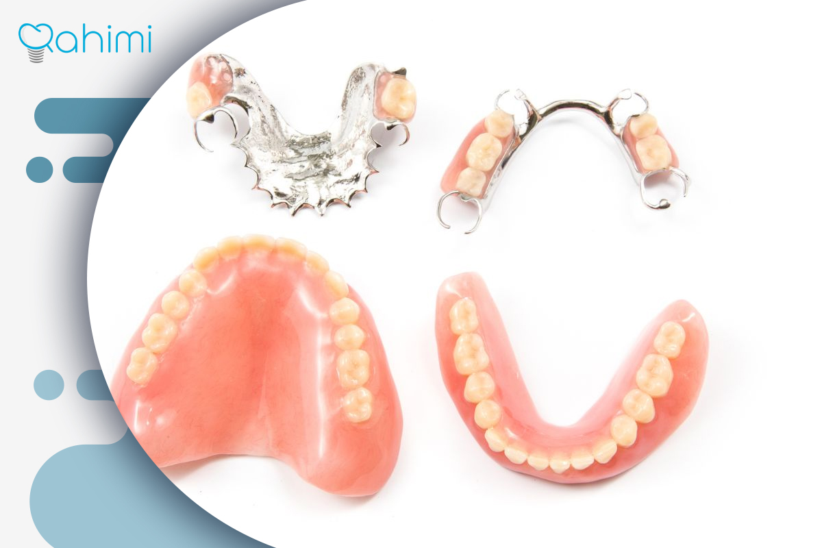 انواع مختلف دندان مصنوعی