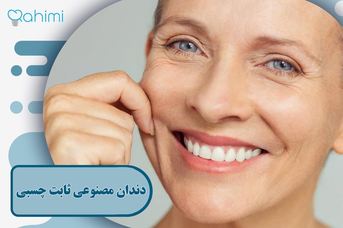 دندان مصنوعی ثابت چسبی