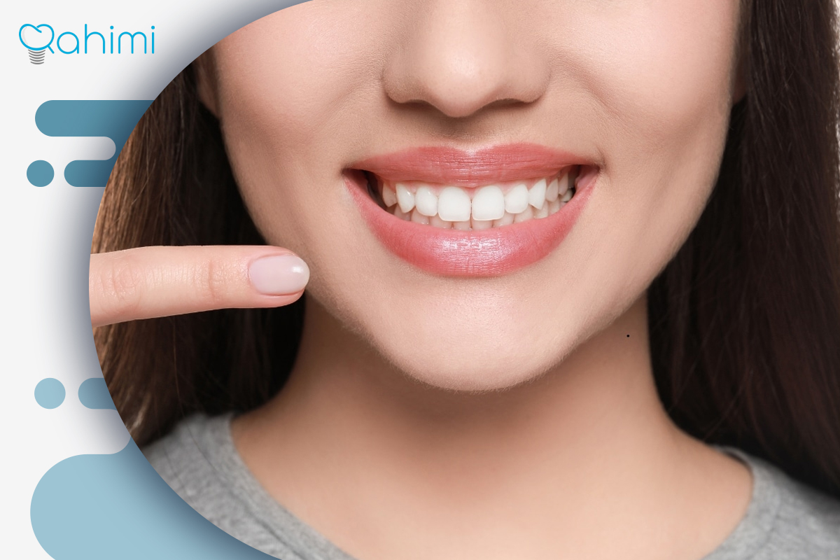 لیفت لثه چیست؟ فواید لیفت لثه با جراحی و لیزر 7 لیفت لثه دائمی