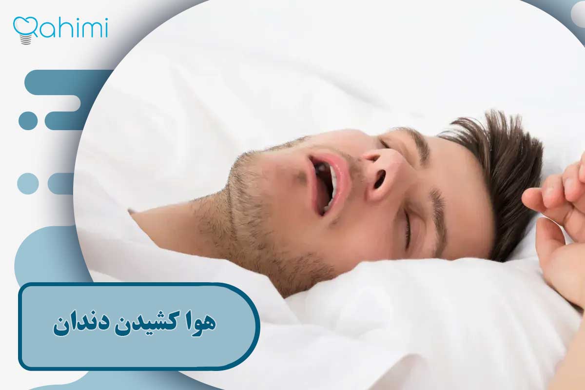 هوا کشیدن دندان